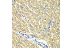 Immunohistochemistry of paraffin-embedded mouse heart using GLRX3 antibody at dilution of 1:100 (x40 lens). (GLRX3 antibody)