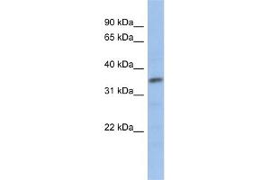 WB Suggested Anti-MYF5 Antibody   Titration: 1 ug/ml   Positive Control: Human Jurkat Cell (MYF5 antibody  (N-Term))