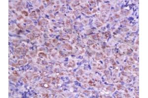 Immunohistochemistry (IHC) image for anti-Cyclin D2 (CCND2) (AA 161-288) antibody (ABIN738366)