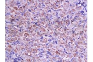 Formalin-fixed and paraffin embedded rat ovary labeled with Anti-Cyclin D2 Polyclonal Antibody, Unconjugated (ABIN738366) at 1:200 followed by conjugation to the secondary antibody and DAB staining. (Cyclin D2 antibody  (AA 161-288))