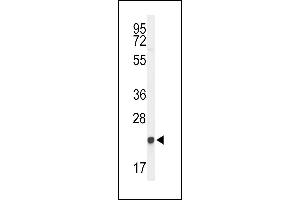 Western blot analysis of GGCT Antibody (C-term) (ABIN653628 and ABIN2842980) in 293 cell line lysates (35 μg/lane). (GGCT antibody  (C-Term))