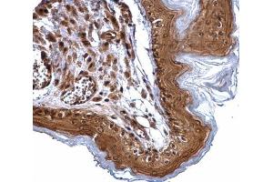 IHC-P Image ERCC2 antibody [N2C2], Internal detects ERCC2 protein at cytosol and nucleus on mouse esophagus by immunohistochemical analysis. (ERCC2 antibody  (Internal Region))