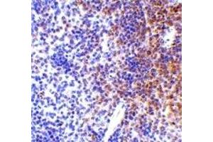 Immunohistochemistry (IHC) image for anti-Interferon Regulatory Factor 7 (IRF7) (Middle Region) antibody (ABIN1030964) (IRF7 antibody  (Middle Region))