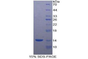 SDS-PAGE (SDS) image for Caveolin 1, Caveolae Protein, 22kDa (CAV1) (AA 2-104) protein (His tag) (ABIN2120785)