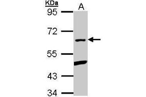 WB Image Sample (30 ug of whole cell lysate) A: Hep G2 , 7.