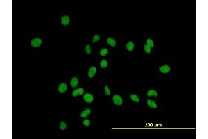 Immunofluorescence of purified MaxPab antibody to ZFP37 on HeLa cell.