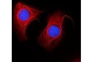 Immunofluorescence (IF) image for anti-Keratin 18 (KRT18) antibody (Alexa Fluor 647) (ABIN2657197) (Cytokeratin 18 antibody  (Alexa Fluor 647))