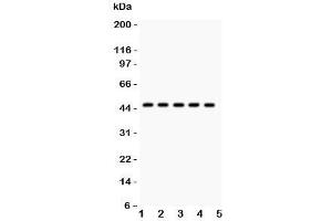 Western blot testing of PIM-1 antibody and human samples 1:  U20S;  2: A549;  3: COLO320;  4: SW620;  5: Jurkat. (PIM1 antibody  (C-Term))