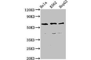 Western Blot Positive WB detected in: Hela whole cell lysate, K562 whole cell lysate, HepG2 whole cell lysate All lanes: CCT5 antibody at 4 μg/mL Secondary Goat polyclonal to rabbit IgG at 1/50000 dilution Predicted band size: 60, 50 kDa Observed band size: 60 kDa (CCT5 antibody  (AA 1-270))