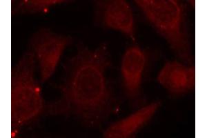 Immunofluorescence staining of methanol-fixed HeLa cells using Phospho-NF2-S518 antibody (ABIN2988202). (Merlin antibody  (pSer518))