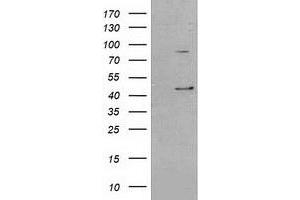 HEK293T cells were transfected with the pCMV6-ENTRY control (Left lane) or pCMV6-ENTRY SERPINB3 (Right lane) cDNA for 48 hrs and lysed. (SERPINB3 antibody)