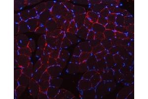 IF analysis of CAV3 using anti-CAV3 antibody (ABIN6719285). (Caveolin 3 antibody  (AA 1-55))