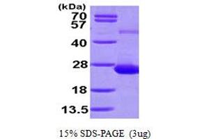 SDS-PAGE (SDS) image for Adenosine Deaminase, tRNA-Specific 2 (ADAT2) (AA 1-191) protein (His tag) (ABIN667820) (ADAT2 Protein (AA 1-191) (His tag))