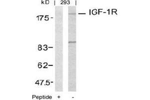 Image no. 3 for anti-Insulin-Like Growth Factor 1 Receptor (IGF1R) (Tyr1161) antibody (ABIN197243)