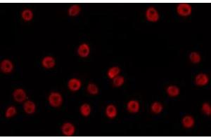 ABIN6266705 staining HuvEc by IF/ICC. (ANP32C antibody  (Internal Region))