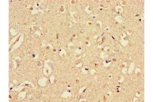 Immunohistochemistry of paraffin-embedded human brain tissue using ABIN7170721 at dilution of 1:100 (Stathmin 1 antibody  (AA 13-78))