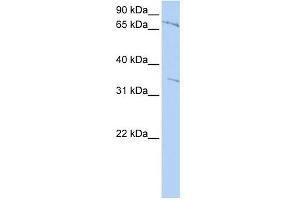 WB Suggested Anti-ZNF224 Antibody Titration:  0.