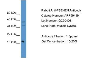 WB Suggested Anti-PSENEN  Antibody Titration: 0. (PEN2 antibody  (C-Term))