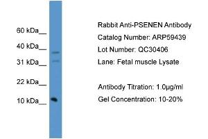 WB Suggested Anti-PSENEN  Antibody Titration: 0.