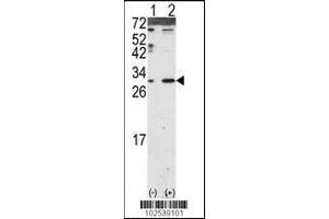 Western blot analysis of DKK2 using DKK2 Antibody using 293 cell lysates (2 ug/lane) either nontransfected (Lane 1) or transiently transfected with the DKK2 gene (Lane 2). (DKK2 antibody  (N-Term))