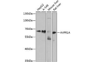 Western blot analysis of extracts of various cell lines, using A antibody (ABIN6129944, ABIN6137377, ABIN6137378 and ABIN6224448) at 1:1000 dilution.