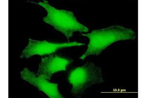 Immunofluorescence of purified MaxPab antibody to ENO1P on HeLa cell. (ENO1P1 antibody  (AA 1-388))