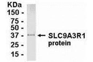 Western Blotting (WB) image for anti-Solute Carrier Family 9, Subfamily A (NHE3, Cation Proton Antiporter 3), Member 3 Regulator 1 (SLC9A3R1) (AA 240-358) antibody (ABIN2468021) (SLC9A3R1 antibody  (AA 240-358))