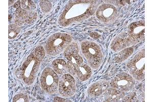 IHC-P Image MCCC2 antibody [N1C1] detects MCCC2 protein at mitochondria in mouse cervix by immunohistochemical analysis. (MCCC2 antibody  (Center))
