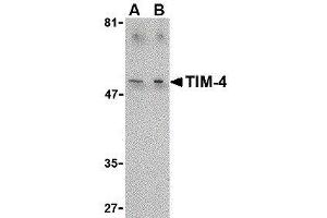 Western Blotting (WB) image for anti-T-Cell Immunoglobulin and Mucin Domain Containing 4 (TIMD4) (C-Term) antibody (ABIN2476822)