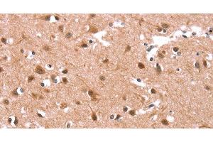 Immunohistochemistry of paraffin-embedded Human brain tissue using KCNJ6 Polyclonal Antibody at dilution 1:40 (KCNJ6 antibody)