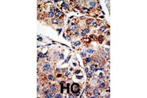 DOT1L antibody  (C-Term)
