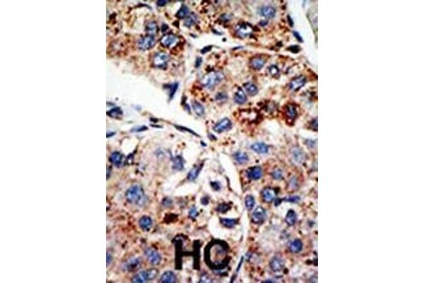 DOT1L antibody  (C-Term)