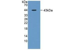 Detection of Recombinant AST, Rat using Polyclonal Antibody to Aspartate Aminotransferase (AST) (GOT1 antibody  (AA 1-413))
