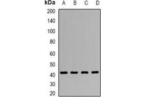 Western blot analysis of Clusterin expression in HepG2 (A), SW480 (B), Hela (C), mouse liver (D) whole cell lysates. (Clusterin antibody)