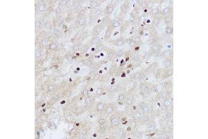 Immunohistochemistry of paraffin-embedded rat liver using OGT Rabbit pAb (ABIN3022707, ABIN3022708, ABIN3022709 and ABIN6219152) at dilution of 1:100 (40x lens).