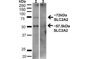 Western blot analysis of Human HeLa and HEK293T cell lysates showing detection of ~57.