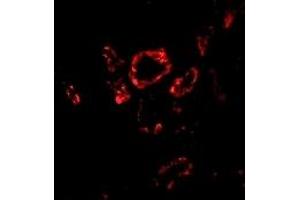Immunofluorescence (IF) image for anti-SLUG (Middle Region 2) antibody (ABIN1031203) (SLUG antibody  (Middle Region 2))