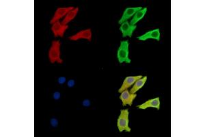 ABIN7095943 and ABIN7100005 staining Hela cells by IF/ICC.