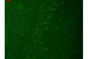 TrpM7 (S74 25), Human hippocampus. (TRPM7 antibody  (AA 1817-1863))