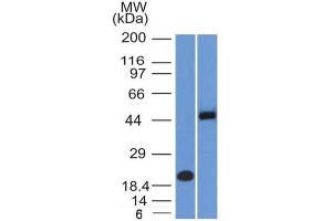 Western Blot Analysis (A) Recombinant Protein (B) Raji cell lysate Using PAX8 Mouse Monoclonal Antibody (PAX8/1492). (PAX8 antibody  (AA 60-261))