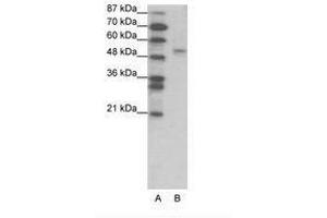 Image no. 1 for anti-Forkhead Box D2 (FOXD2) (AA 39-88) antibody (ABIN202659) (FOXD2 antibody  (AA 39-88))