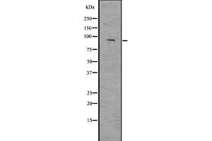 Western blot analysis of SMURF2 using Jurkat whole  lysates. (SMURF2 antibody  (Internal Region))