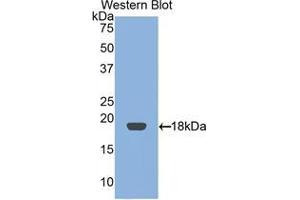 Western blot analysis of the recombinant protein. (RBP2 antibody  (AA 1-134))