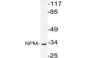 Western blot (WB) analysis of NPM antibody in extracts from HeLa cells. (NPM1 antibody)