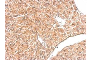 IHC-P Image Amphiphysin antibody [N1N2], N-term detects AMPH protein at cytosol on U87 xenograft by immunohistochemical analysis. (Amphiphysin antibody  (N-Term))