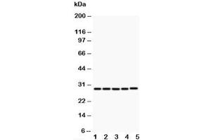 Western blot testing of CD40L antibody and Lane 1:  MCF-7;  2: HeLa;  3: Jurkat;  4: HMY2;  5: COLO320;  Predicted size: 29KD;  Observed size: 29KD (CD40 Ligand antibody  (N-Term))