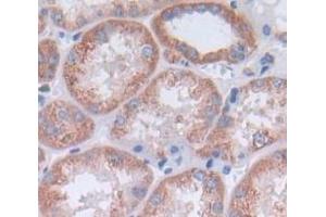 IHC-P analysis of Kidney tissue, with DAB staining. (CCL14 antibody  (AA 20-93))