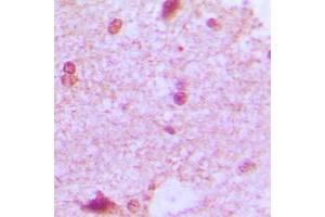 Immunohistochemical analysis of ZHX2 staining in human brain formalin fixed paraffin embedded tissue section. (ZHX2 antibody  (C-Term))