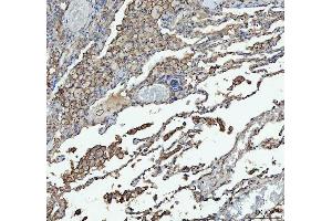 IHC analysis of ACE using anti-ACE antibody (ABIN3043777). (Angiotensin I Converting Enzyme 1 antibody  (AA 651-864))