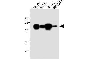 All lanes : Anti-METTL14 Antibody (N-Term) at 1:2000 dilution Lane 1: HL-60 whole cell lysate Lane 2: A431 whole cell lysate Lane 3: Jurkat whole cell lysate Lane 4: NIH/3T3 whole cell lysate Lysates/proteins at 20 μg per lane.